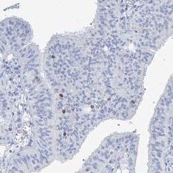 SGOL2 Antibody, Novus Biologicals 0.1mL; Unlabeled:Antibodies, Polyclonal